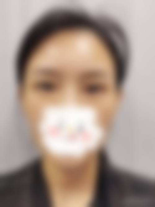 天津医 科 大学朱宪彝纪念医院眼科治疗反馈与口碑评价。