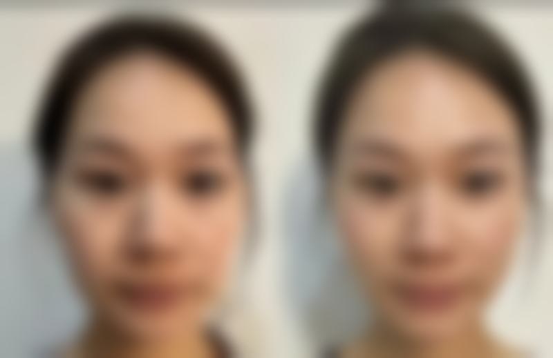 张家港万春医院整形美容中 心医生团队经验稳定。