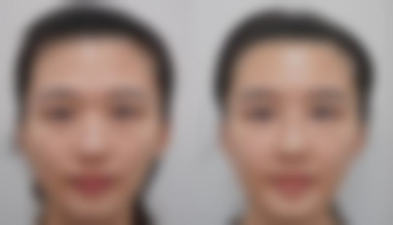 刘汉敏医生擅长的项目