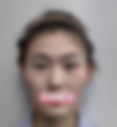 灌云星之美整形医院擅长项目。
