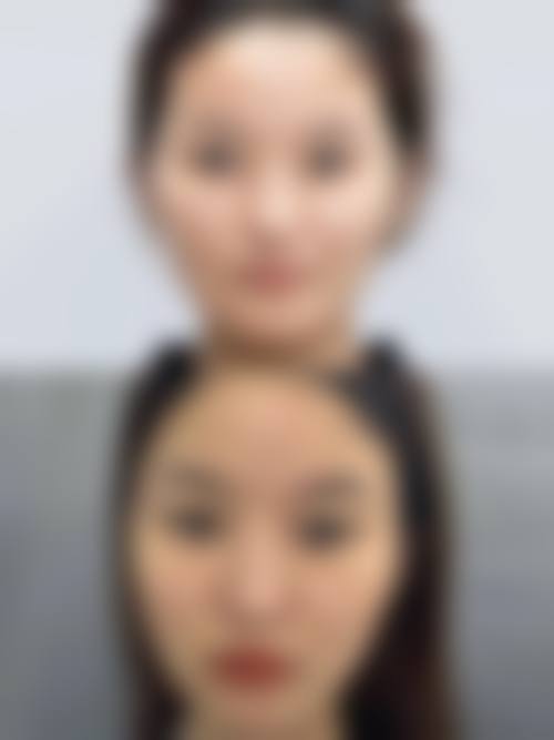 台州优颜嘉整形医院治疗反馈与口碑评价