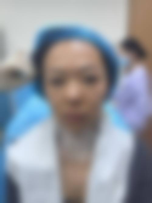 灌云星之美整形医院治疗反馈与口碑评价。