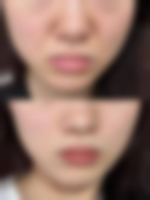 灌云星之美整形医院预约挂号方式。