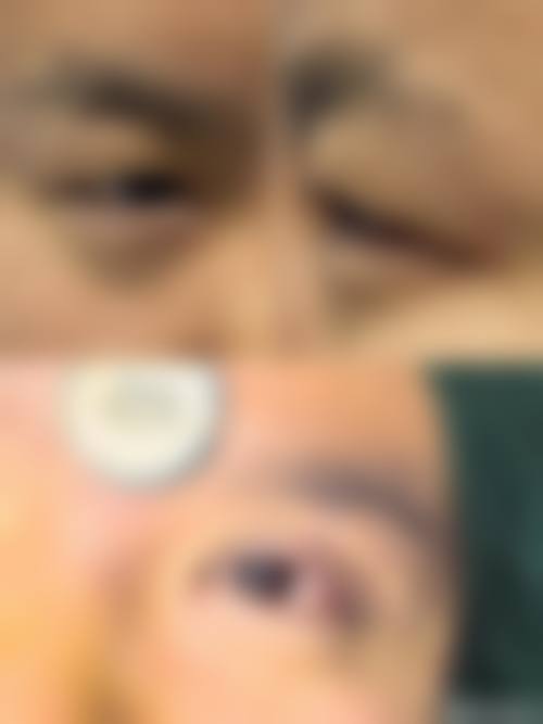 蚌埠市第一人民医院眼科擅长项目。