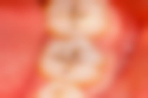 江苏常州舒婷口腔擅长项目。