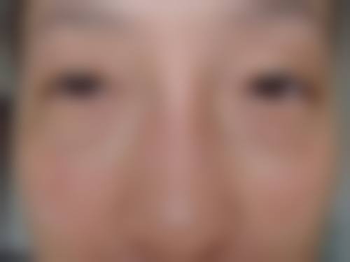 东莞市松山湖瓷美人美容门诊部治疗反馈与口碑评价。