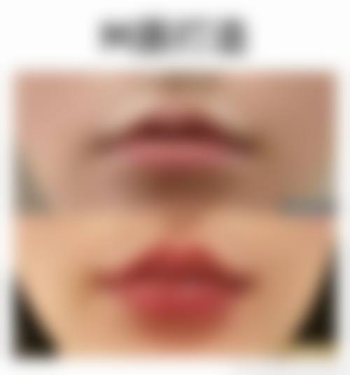 东莞市松山湖瓷美人美容门诊部地理位置便于到院。