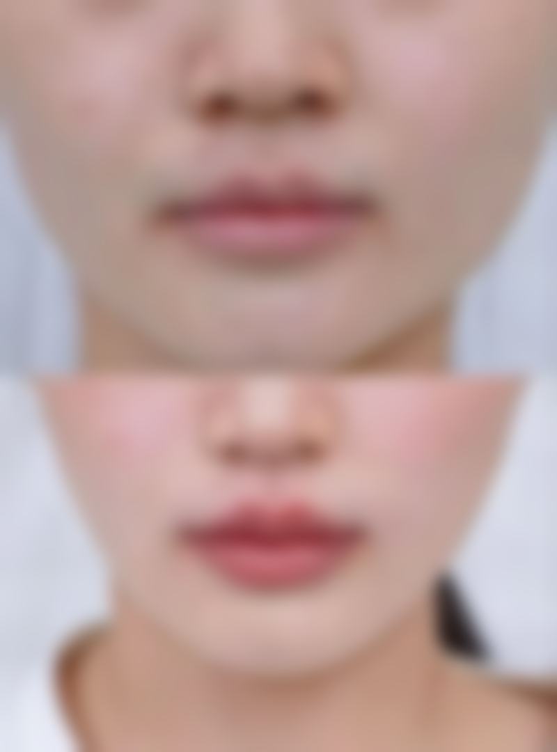 广州鸿视眼视光中 心的简介