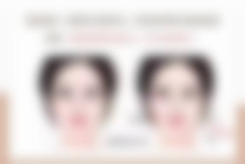 无锡云水瑶医疗美容诊所治疗反馈与口碑评价。