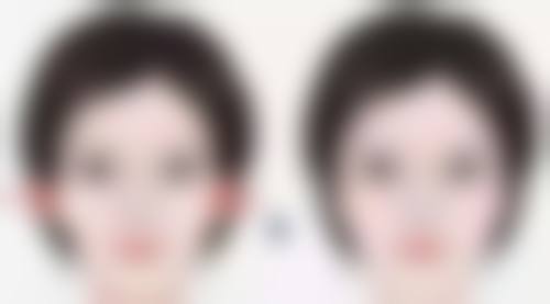 夏秉成医生的擅长项目