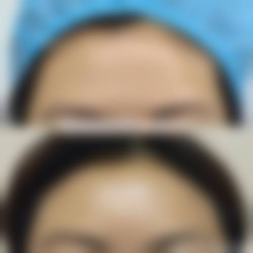 福鼎希洛缇整形医院擅长项目。