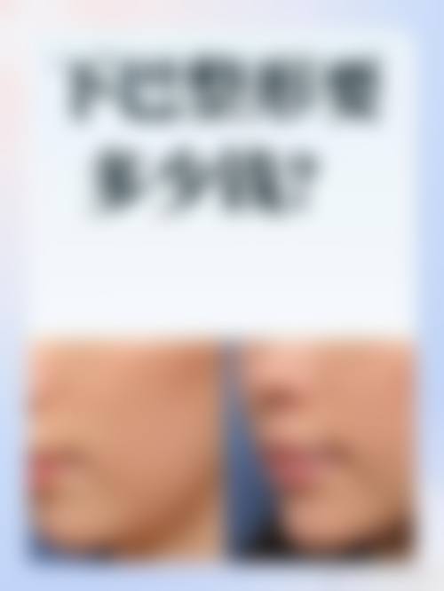 陈艳芳医生技术实力展现