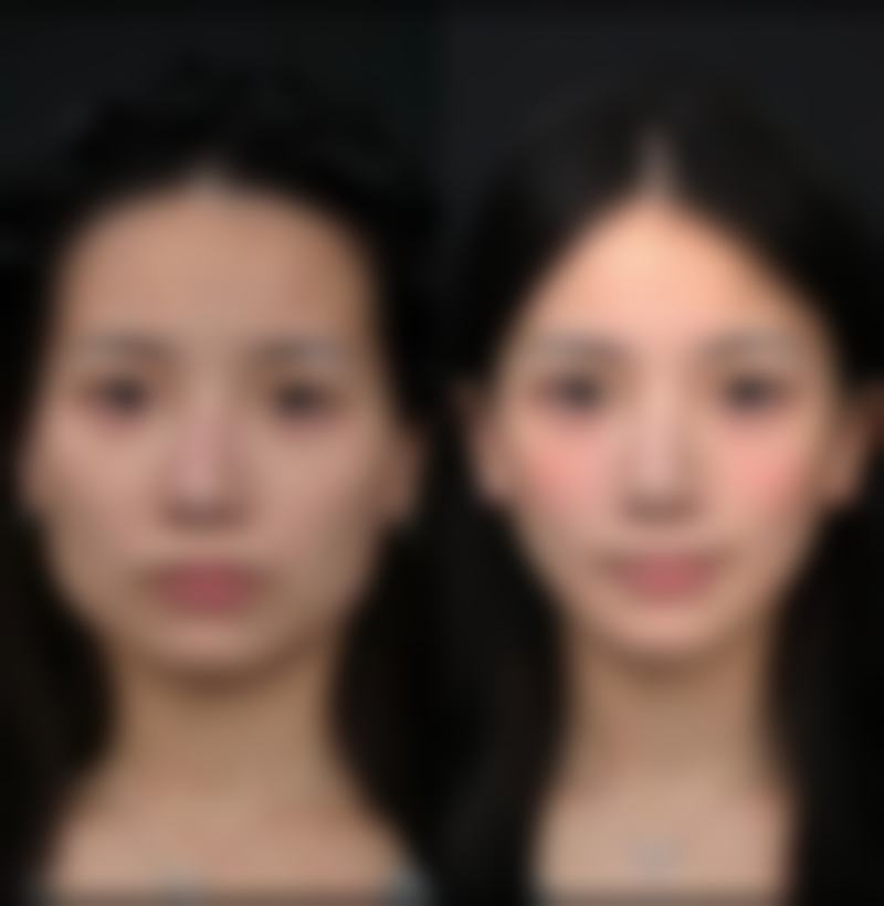 罗文婷医生的技术实力