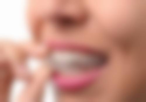 杭州茗芽口腔门诊部口碑评价
