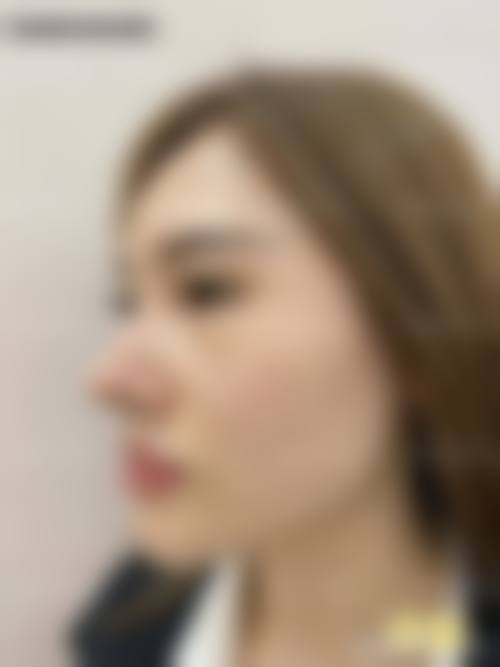 沈阳沈河茗湲医美医疗美容门诊部擅长项目。