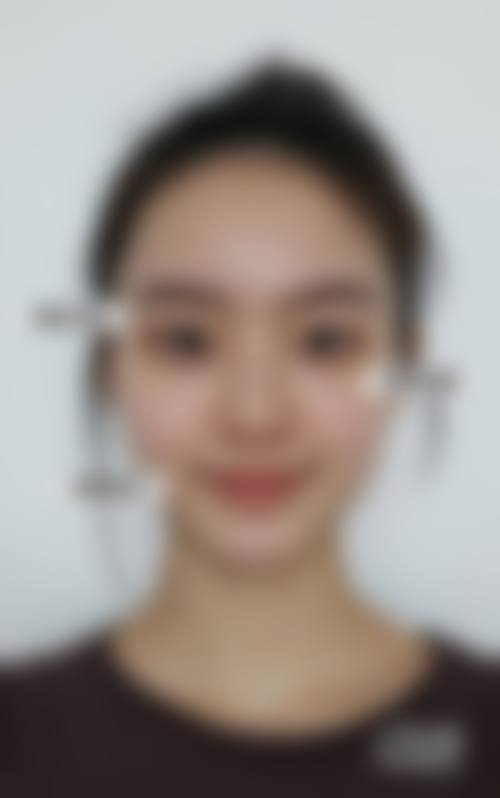 厦门时间之前医疗美容诊所治疗反馈与口碑评价。