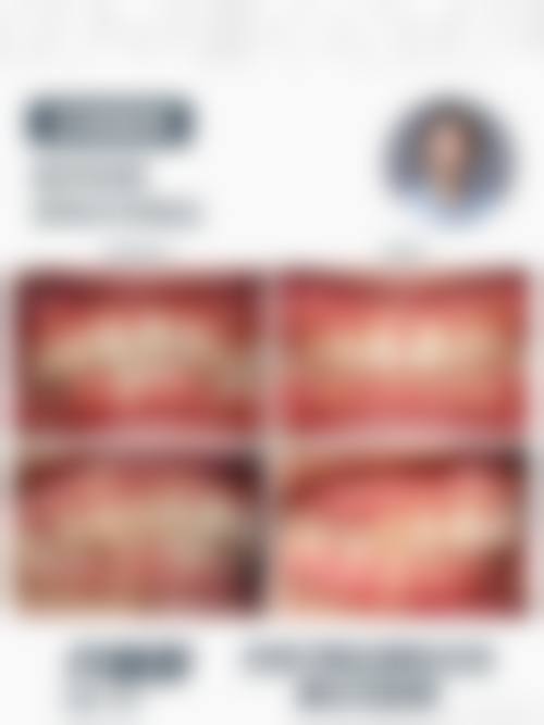 广东肇庆肇齿口腔治疗反馈与口碑评价。