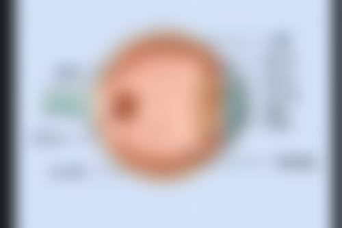 准格尔旗中蒙医院眼科的擅长项目