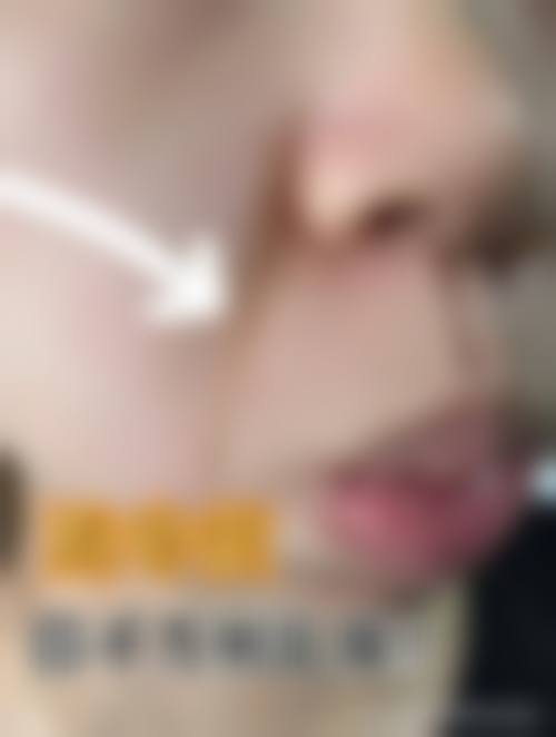 新泰侨艺外科美容诊所治疗反馈与口碑评价。