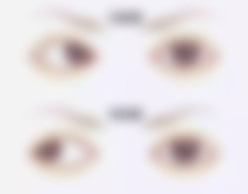 天水博视眼科医院擅长项目。