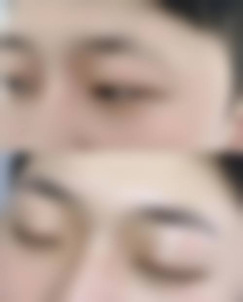 周口慧慧姜伟医疗美容诊所擅长项目。