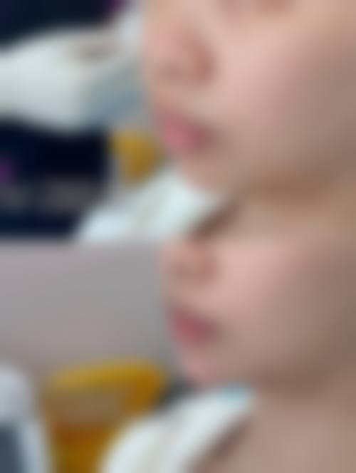 云南昆明彼心医疗美容门诊部医生团队经验稳定。