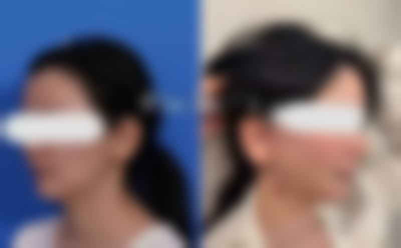 郴州曹家整形医疗美容门诊部口碑评价