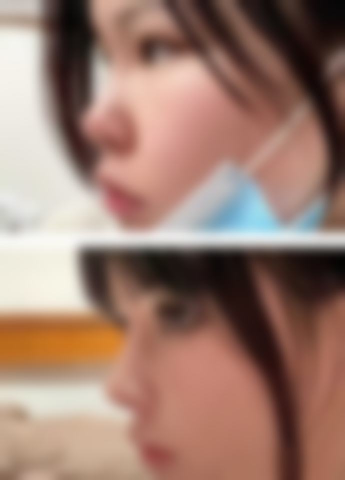 河南大学附属南石医院烧伤整形美容中 心擅长项目