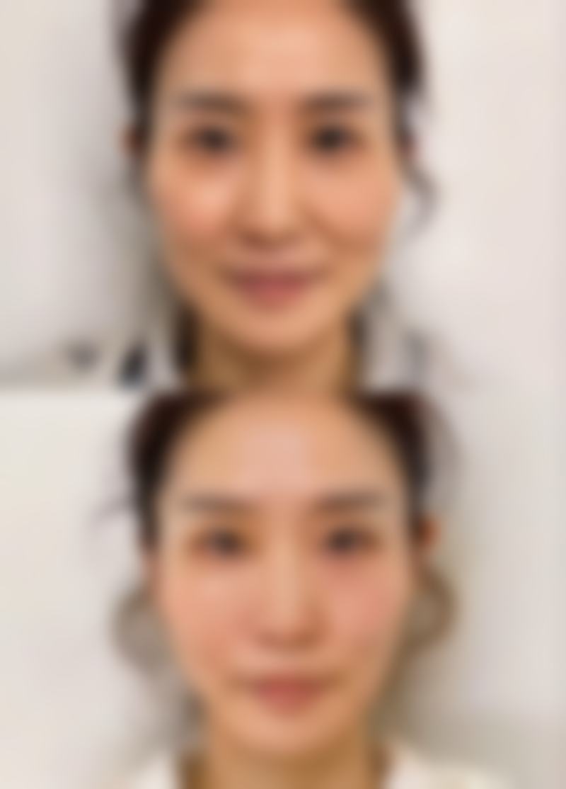 新泰侨艺外科美容诊所2026年价格收费表: