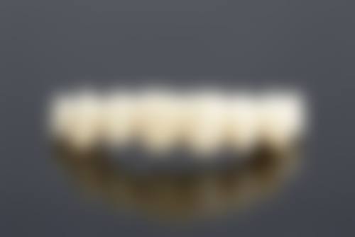 选对拔牙做正畸的时机
