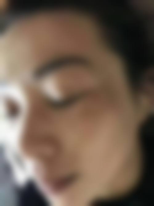 济南Area88医疗美容门诊部擅长项目。
