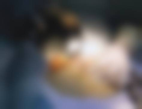 吉安天使医疗美容预约挂号方式