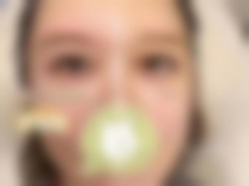 天津中慈漾格医疗美容诊所治疗反馈与口碑评价。