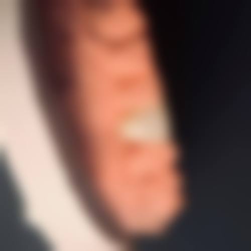 新疆库车锐珂口腔预约挂号方式。