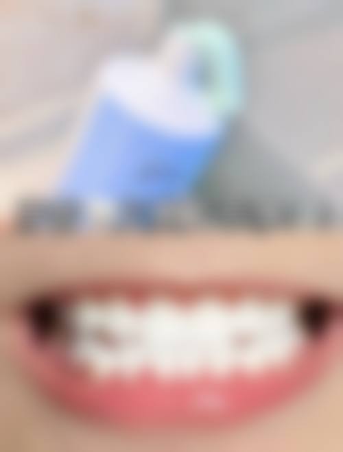 五、乳山圣贝口腔收费价格表