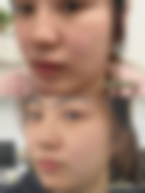 乌鲁木齐阳光天使整形医院擅长项目。