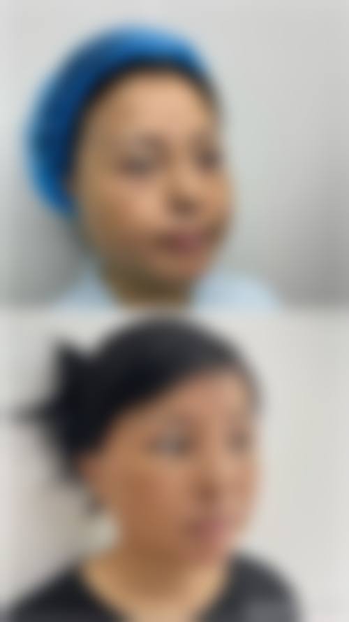 重庆珍颜医疗美容诊所擅长项目。