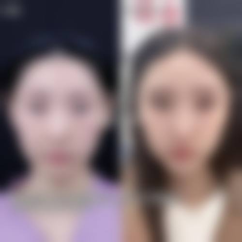 通辽赛美瑞整形医院治疗反馈与口碑评价