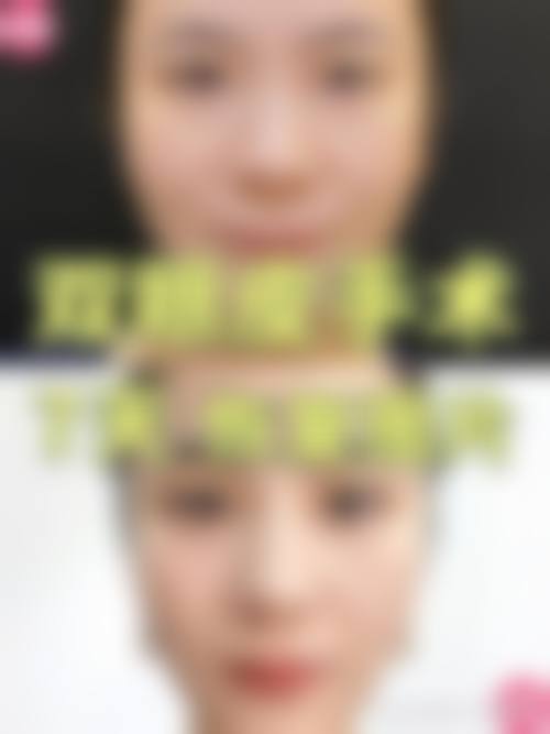 通辽赛美瑞整形医院预约挂号方式