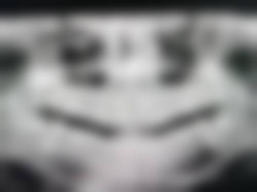 青岛华韩口腔治疗反馈与口碑评价。