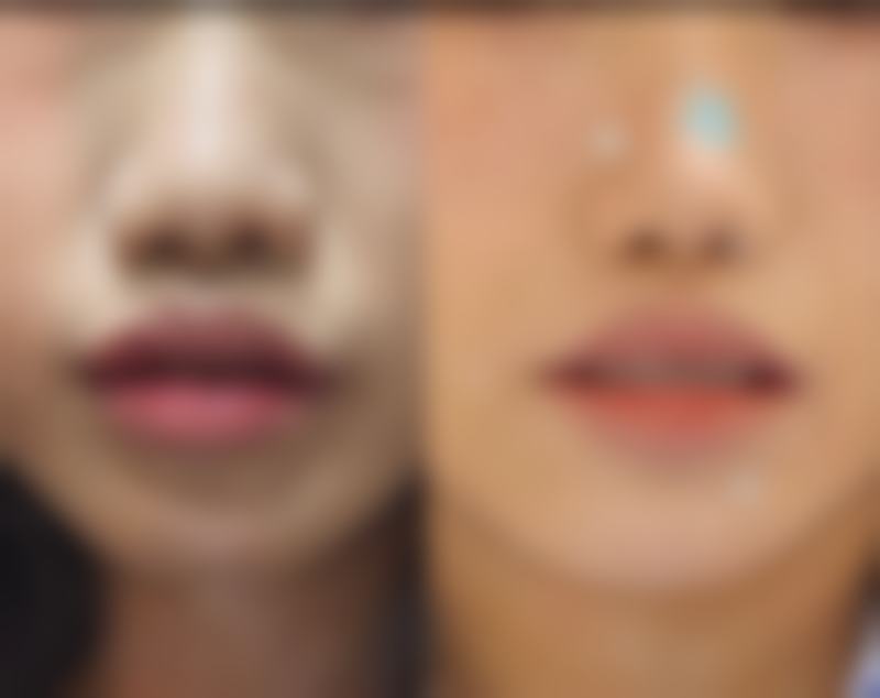 沈阳汇美人医疗美容诊所擅长的项目