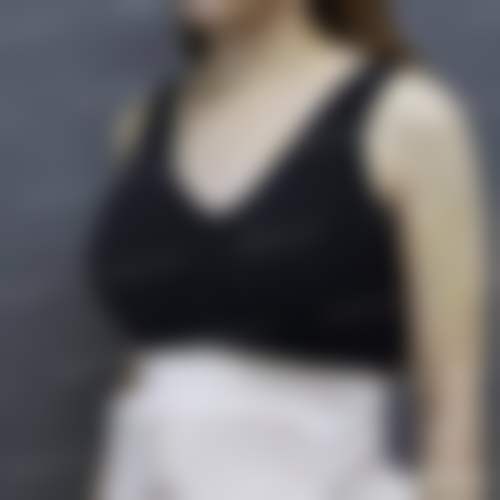 北京美漾整形门诊部顾客实例情况