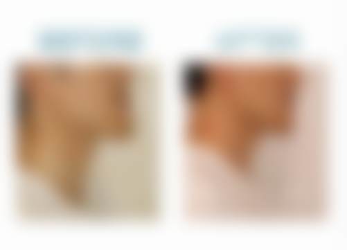 北京禾禾口腔门诊部王犇医生韩国登特种植牙6800元起，效果好技术优助您重享健康咀嚼