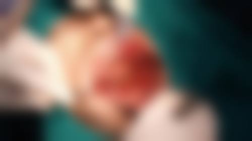 广东中山刘立琴口腔诊所治疗反馈与口碑评价。