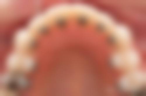 八、杭州亮丽口腔诊所怎么预约?