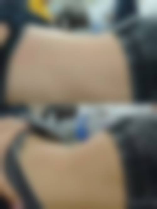 海南海口梦妮幻整形医院擅长项目。