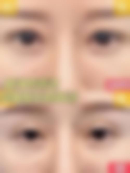 日照市人民医院眼科2026年价格收费表：