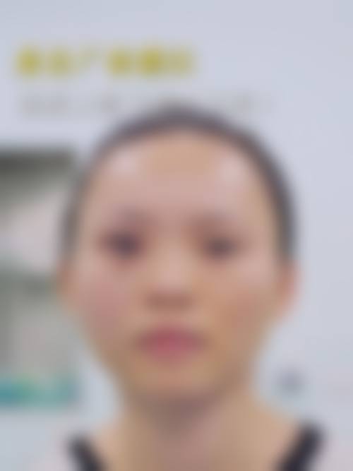 日照市人民医院眼科预约挂号方式。