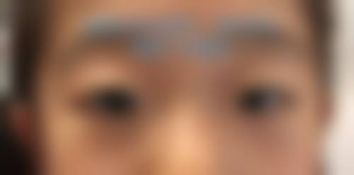 日照市人民医院眼科治疗反馈与口碑评价。