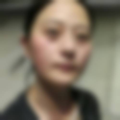 日照市人民医院眼科地理位置便于到院。